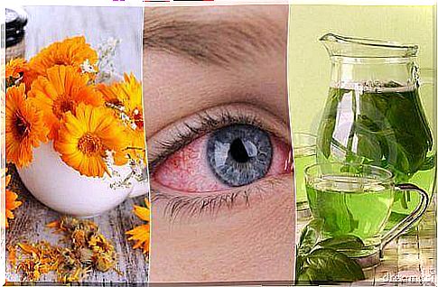 5 home remedies for conjunctivitis