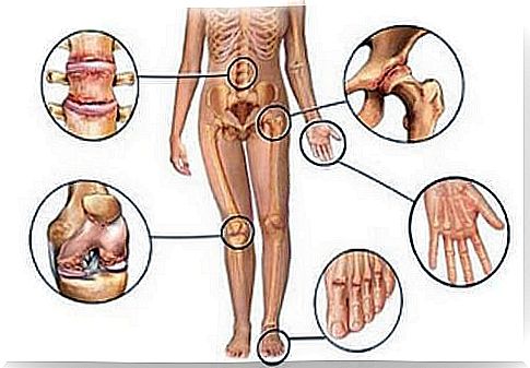 5 natural anti-inflammatory drugs for joint pain