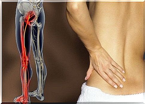 6 simple exercises for sciatica pain