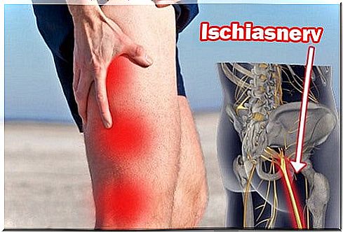 Sciatica pain in the leg