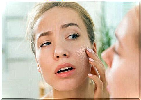 Dry skin: what are the causes