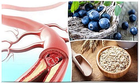 Healthy Arteries: These 9 Foods Can Help