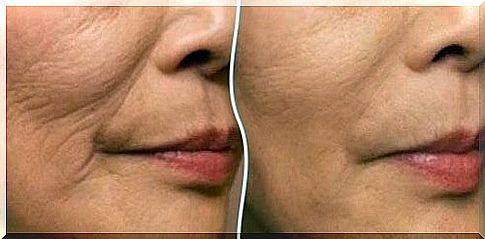 How to avoid wrinkles in the mouth area