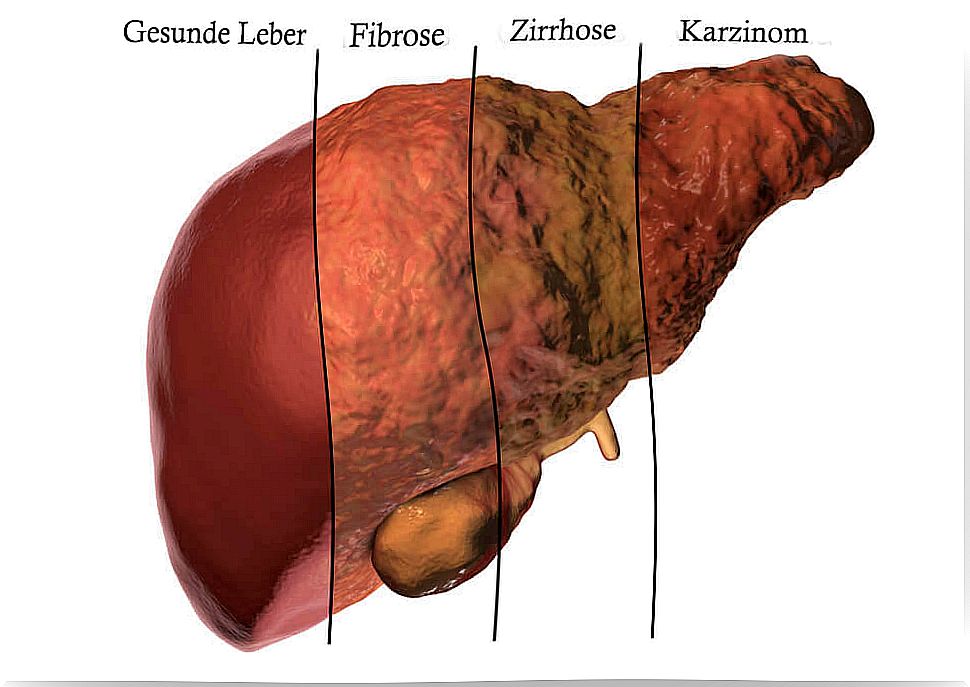 Liver metabolism and liver diseases