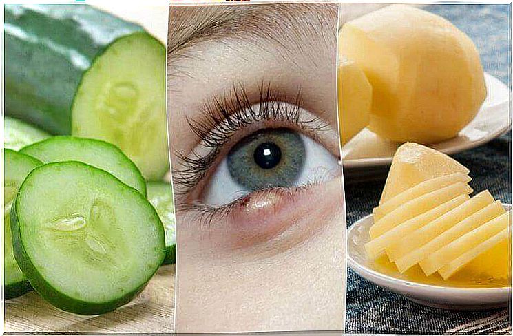 Stye on the eye: 5 home remedies will help