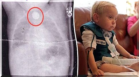 The story of the baby who swallowed a button cell