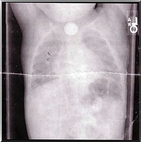 X-ray image