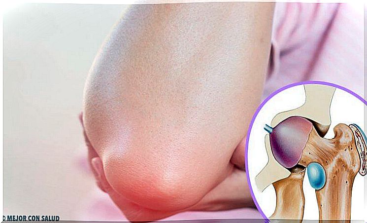 Interesting facts about bursitis