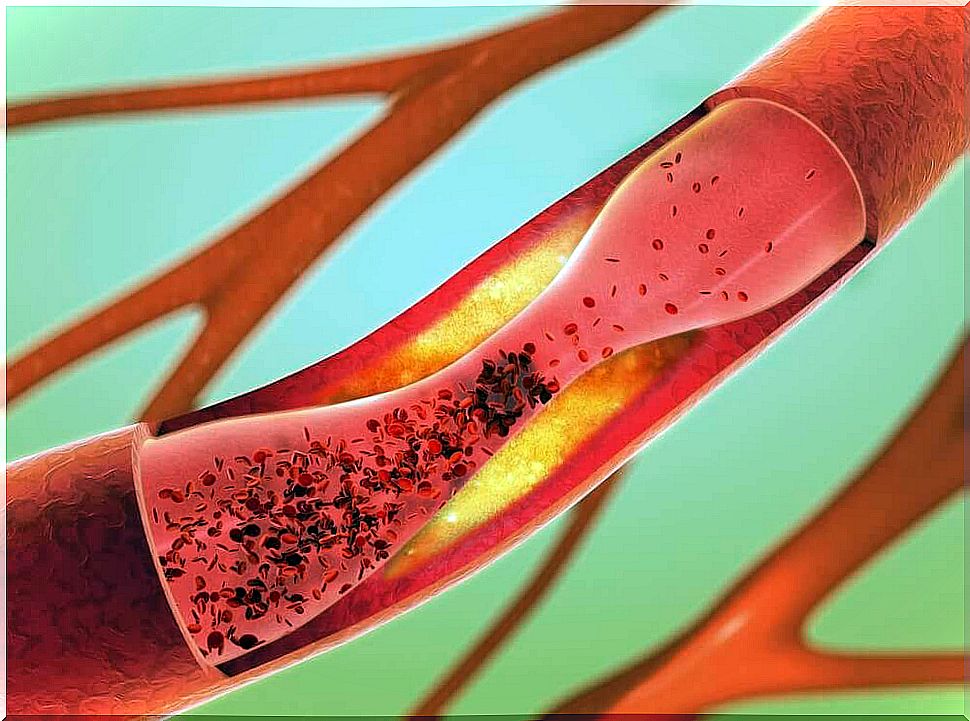 This is how you can protect your blood vessels