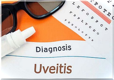 What are the symptoms of uveitis?