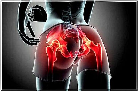 Gluteal Tendinopathy Chart