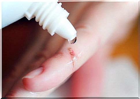 Wound healing: keep scars as small as possible